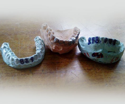 Artificial Teeth Manufacturer Cochin